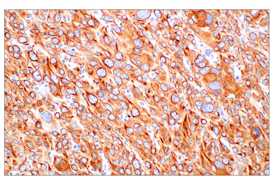 Immunohistochemistry Image 9: Pan-Keratin (Type I) (E6S1S) Rabbit Monoclonal Antibody