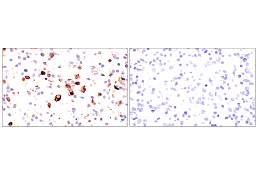 Immunohistochemistry Image 7: MMP-8 (E1C4L) Rabbit Monoclonal Antibody