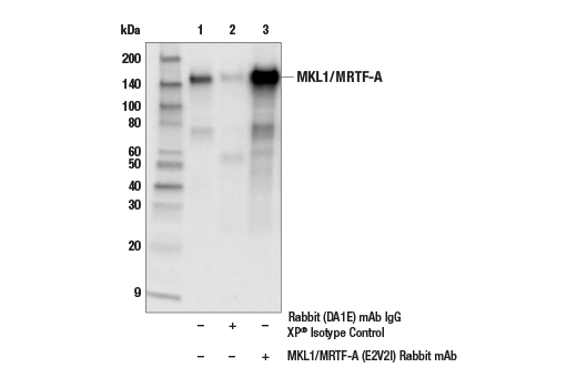 Immunoprecipitation Image 1: MKL1/MRTF-A (E2V2I) Rabbit Monoclonal Antibody