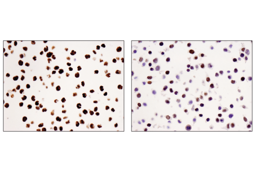 Immunohistochemistry Image 1: WHSC1L1 (D4N9N) Rabbit Monoclonal Antibody (BSA and Azide Free)