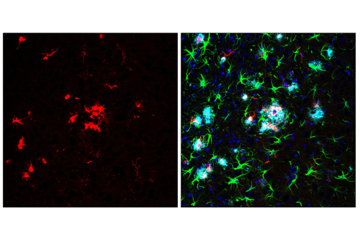 Immunofluorescence Image 2: p22phox (E7Y1F) Rabbit Monoclonal Antibody (BSA and Azide Free)
