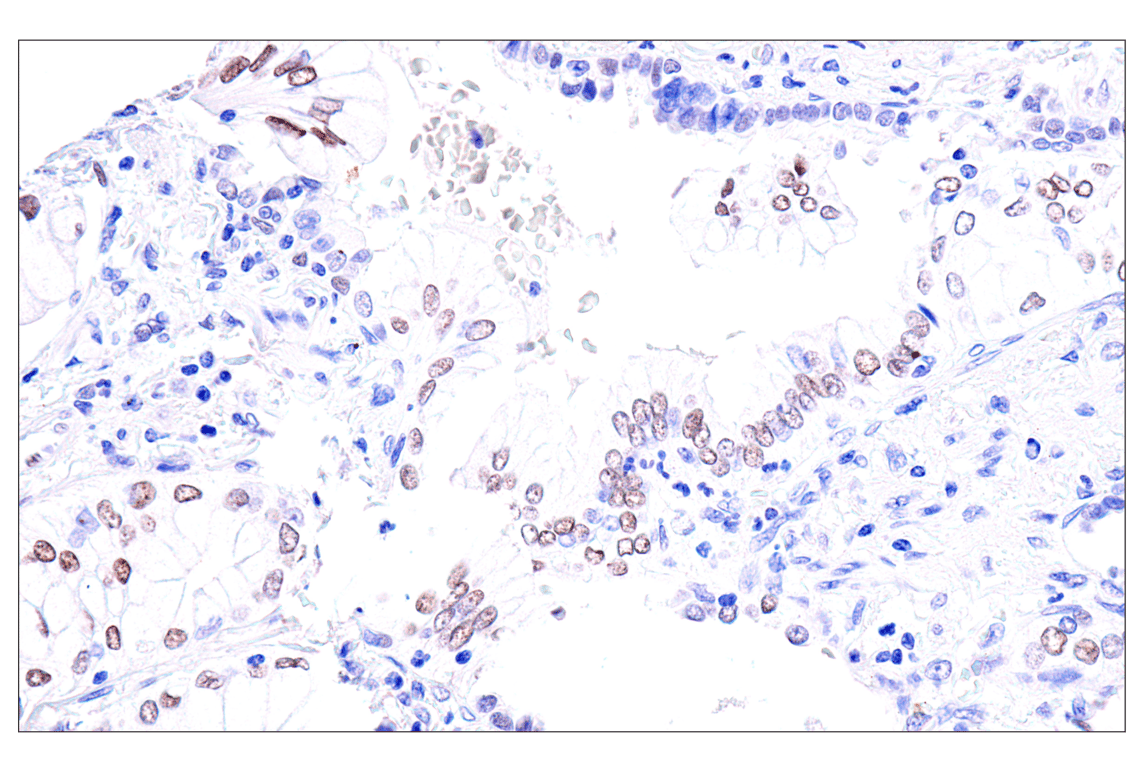 Immunohistochemistry Image 6: GATA-6 (D61E4) XP<sup>®</sup> Rabbit mAb (BSA and Azide Free)