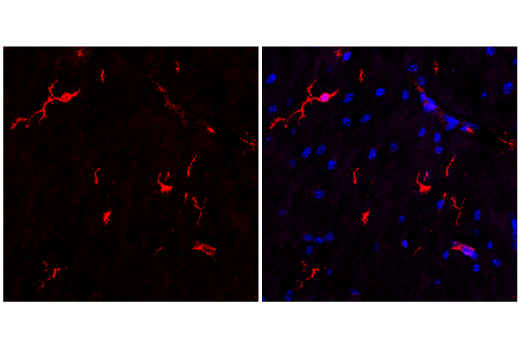 Immunofluorescence Image 2: SHIP1 (E8M5D) Rabbit Monoclonal Antibody
