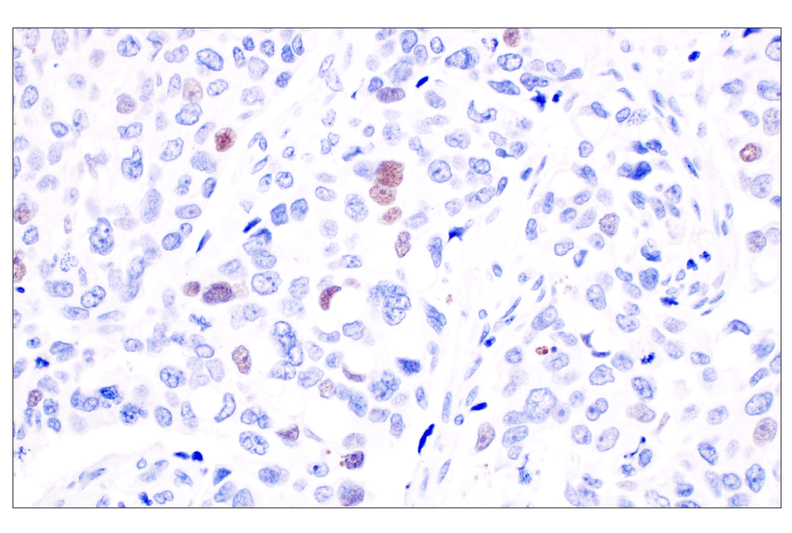 undefined Image 7: PhosphoPlus<sup>®</sup> DNA-PKcs (Ser2056) Antibody Duet