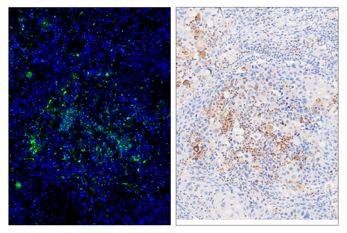 Immunohistochemistry Image 3: IL-8 (E5F5Q) & CO-0178-488 SignalStar<sup>®</sup> Oligo-Antibody Pair