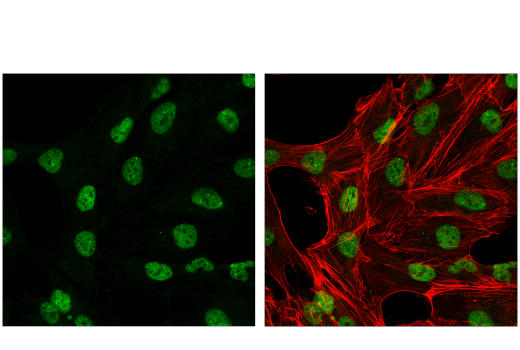 Immunofluorescence Image 1: CBX4 (E6L7X) Rabbit Monoclonal Antibody