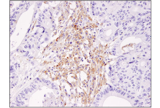 Immunohistochemistry Image 2: TIM-3 (D5D5R<sup>™</sup>) Rabbit Monoclonal Antibody
