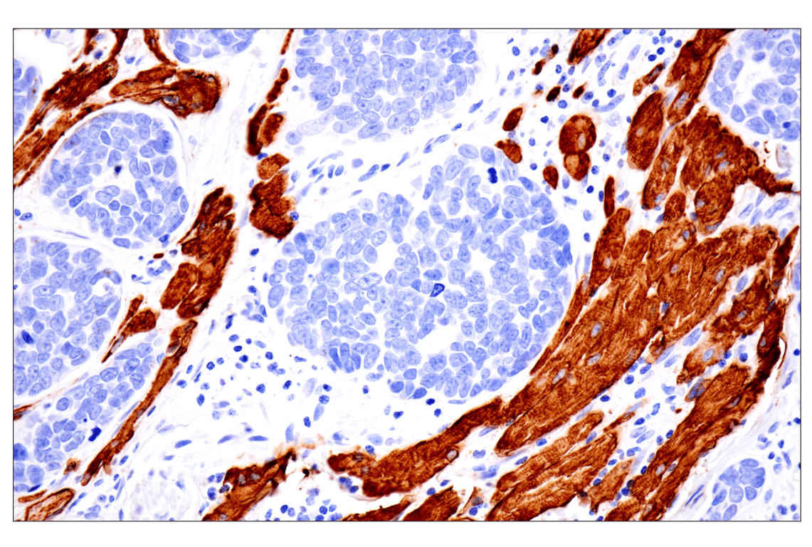 Immunohistochemistry Image 1: Desmin (F5V4I) Rabbit Monoclonal Antibody (BSA and Azide Free)