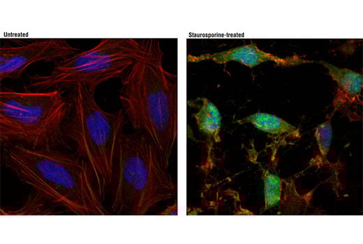 Immunofluorescence Image 1: Cleaved Caspase-7 (Asp198) (D6H1) Rabbit Monoclonal Antibody