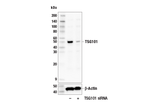 Western Blotting Image 2: TSG101 (E6V1X) Rabbit Monoclonal Antibody