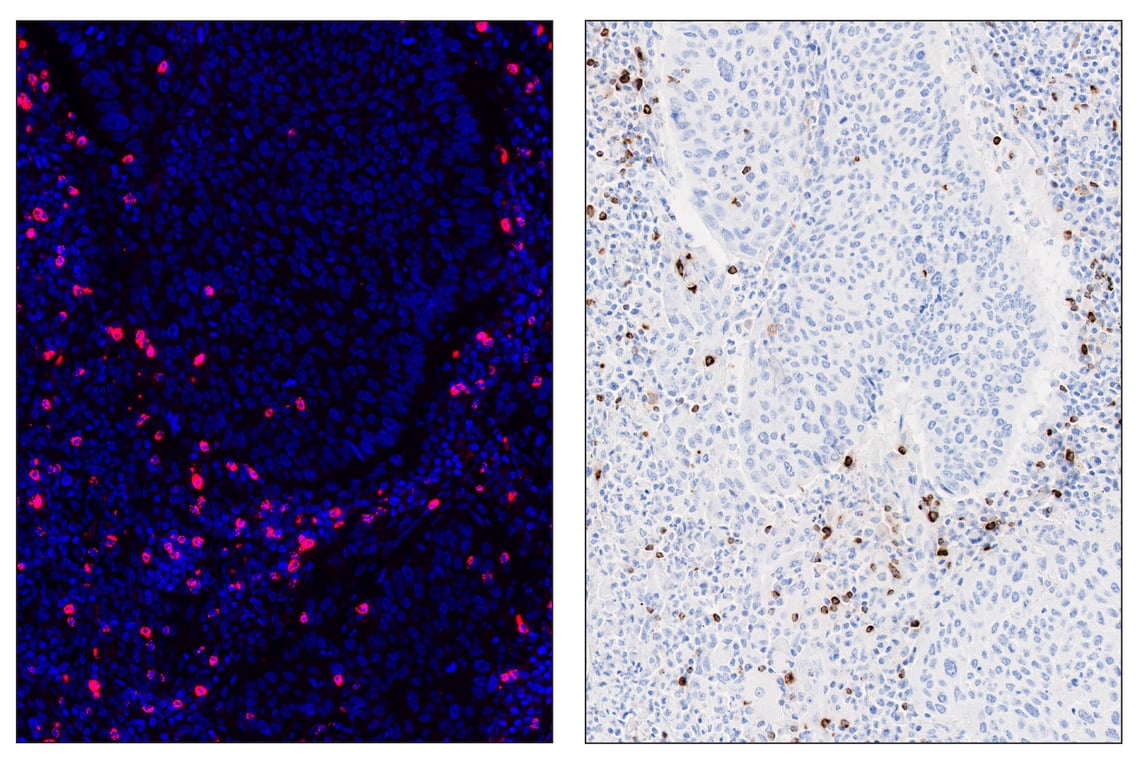Immunohistochemistry Image 6: Granzyme B (D6E9W) & CO-0009-594 SignalStar<sup>™</sup> Oligo-Antibody Pair