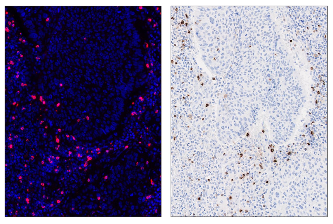 Immunohistochemistry Image 6: Granzyme B (D6E9W) & CO-0009-647 SignalStar<sup>™</sup> Oligo-Antibody Pair