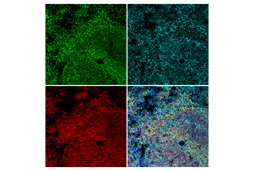 Immunofluorescence Image 5: TIPE2 (E5Q2S) Rabbit Monoclonal Antibody