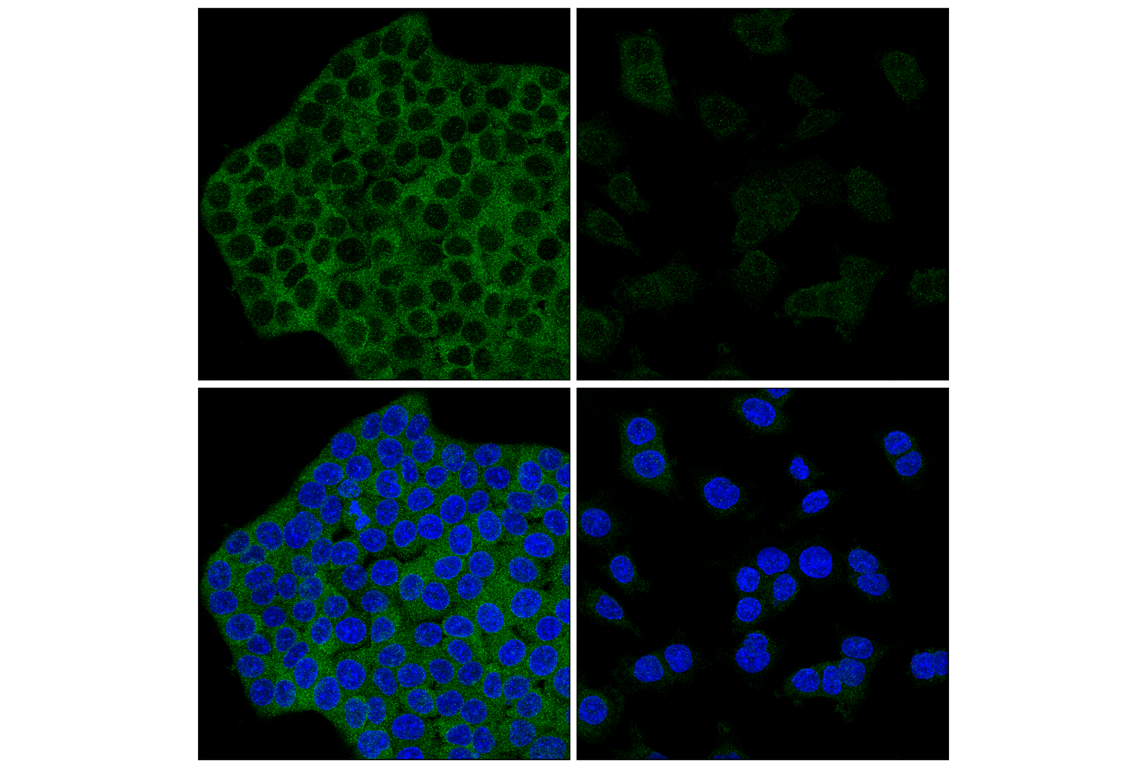Immunofluorescence Image 2: Atg7 (F4V2N) Rabbit Monoclonal Antibody