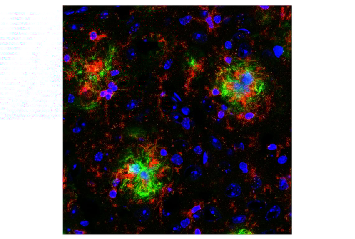 Immunofluorescence Image 1: CD11b/ITGAM (E6E1M) Rabbit Monoclonal Antibody