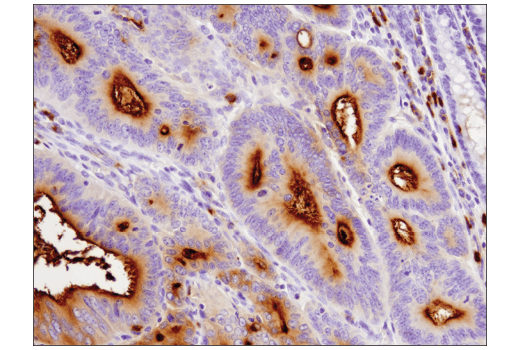 Immunohistochemistry Image 1: CEACAM1 (D3R8O) Rabbit Monoclonal Antibody (BSA and Azide Free)