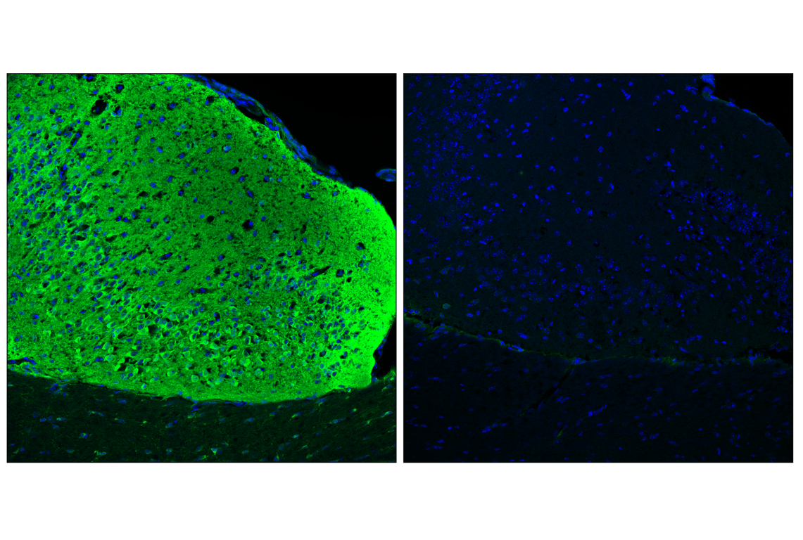 Immunofluorescence Image 1: Phospho-Tau (Thr205) (E9A7P) Mouse Monoclonal Antibody