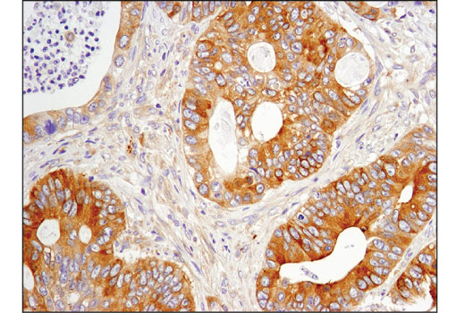 Immunohistochemistry Image 1: Phospho-CAD (Ser1859) (D5K5W) Rabbit Monoclonal Antibody
