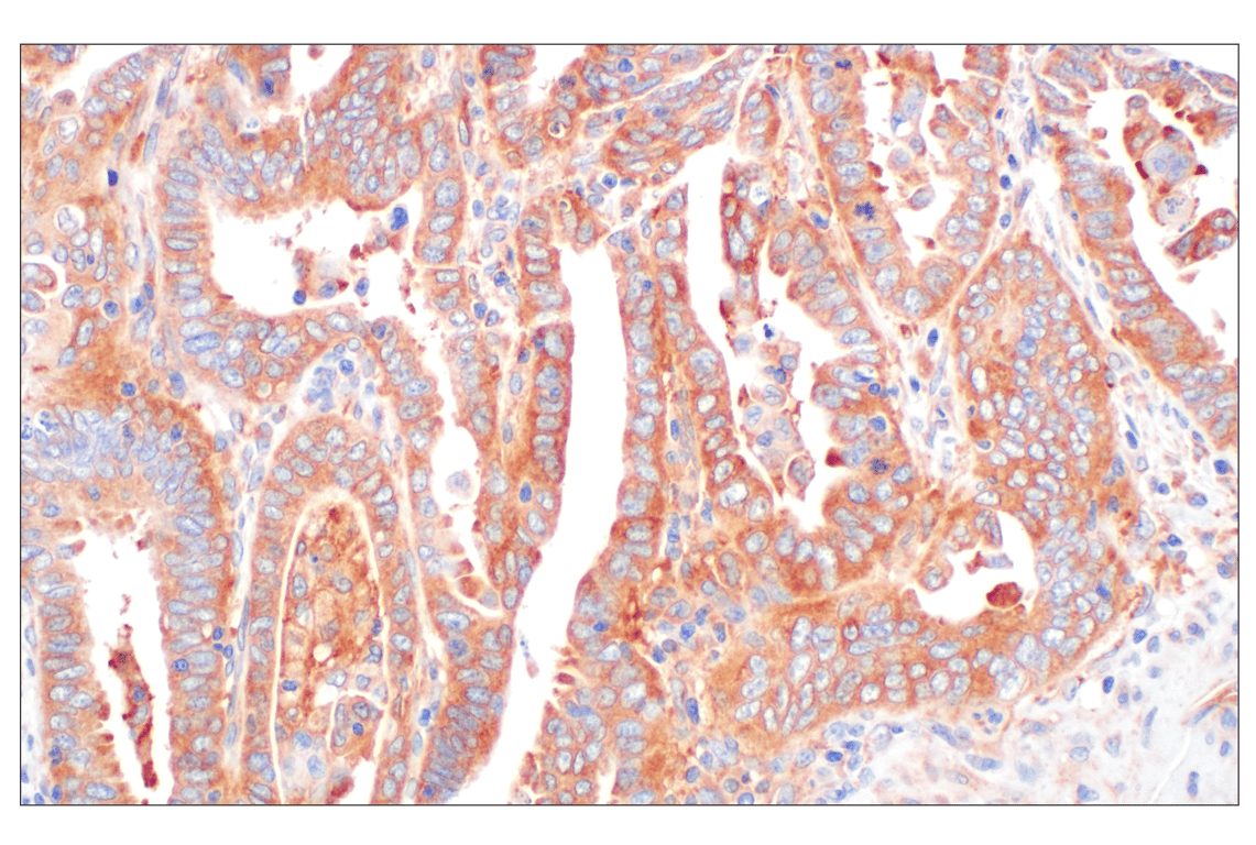 Immunohistochemistry Image 5: EEA1 (E9Q6G) Mouse Monoclonal Antibody