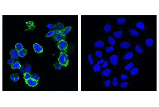 Immunofluorescence Image 2: TIGIT (E5Y1W) Rabbit Monoclonal Antibody