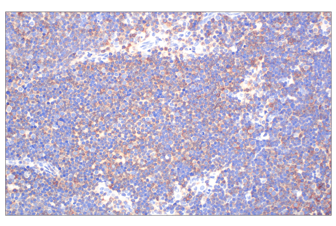 Immunohistochemistry Image 5: CD27 (F3R2V) Rabbit Monoclonal Antibody