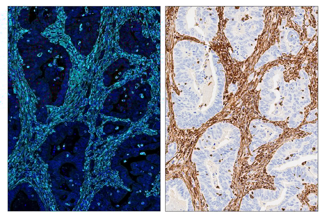 Immunohistochemistry Image 6: Vimentin (D21H3) & CO-0012-488 SignalStar<sup>™</sup> Oligo-Antibody Pair