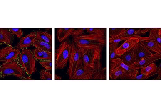 undefined Image 18: beta-Catenin Antibody Sampler Kit