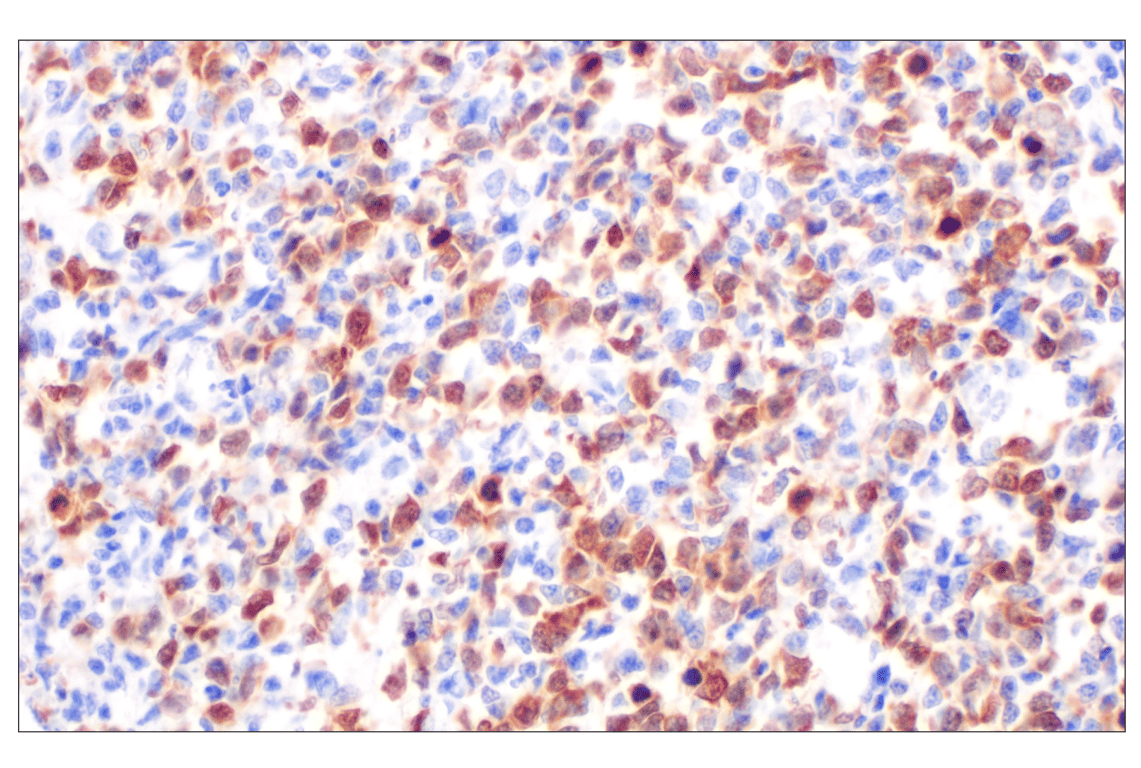 Immunohistochemistry Image 7: Thymidine Kinase 1 (E2H7Z) Rabbit Monoclonal Antibody