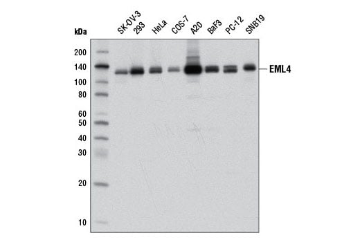 Western Blotting Image 1: EML4 (D7Y8F) XP<sup>®</sup> Rabbit mAb