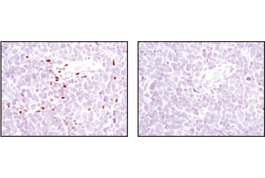 Immunohistochemistry Image 1: 5-Lipoxygenase (C49G1) Rabbit Monoclonal Antibody