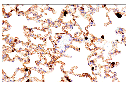 undefined Image 40: Xenophagy Antibody Sampler Kit