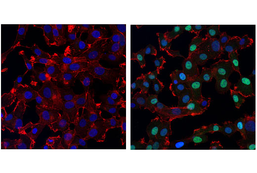 Immunofluorescence Image 1: Phospho-SMAD1 (Ser463/465)/ SMAD5 (Ser463/465)/ SMAD9 (Ser465/467) (D5B10) Rabbit Monoclonal Antibody
