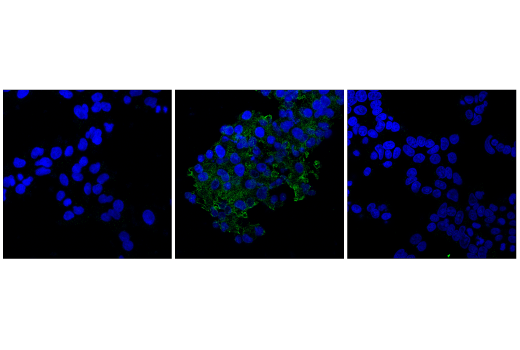 Immunofluorescence Image 1: Cleaved Gasdermin E (Asp270) (E8G4U) Rabbit Monoclonal Antibody