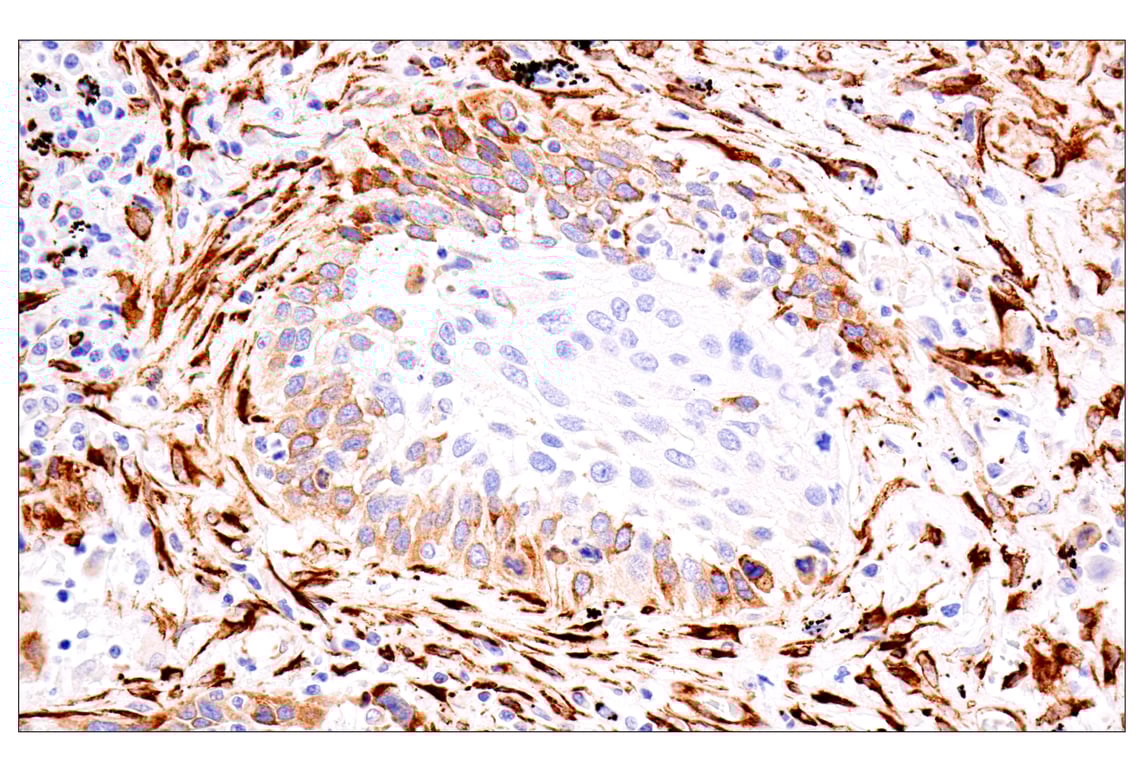 Immunohistochemistry Image 3: HSP47/SERPINH1 (E4A8P) Rabbit Monoclonal Antibody