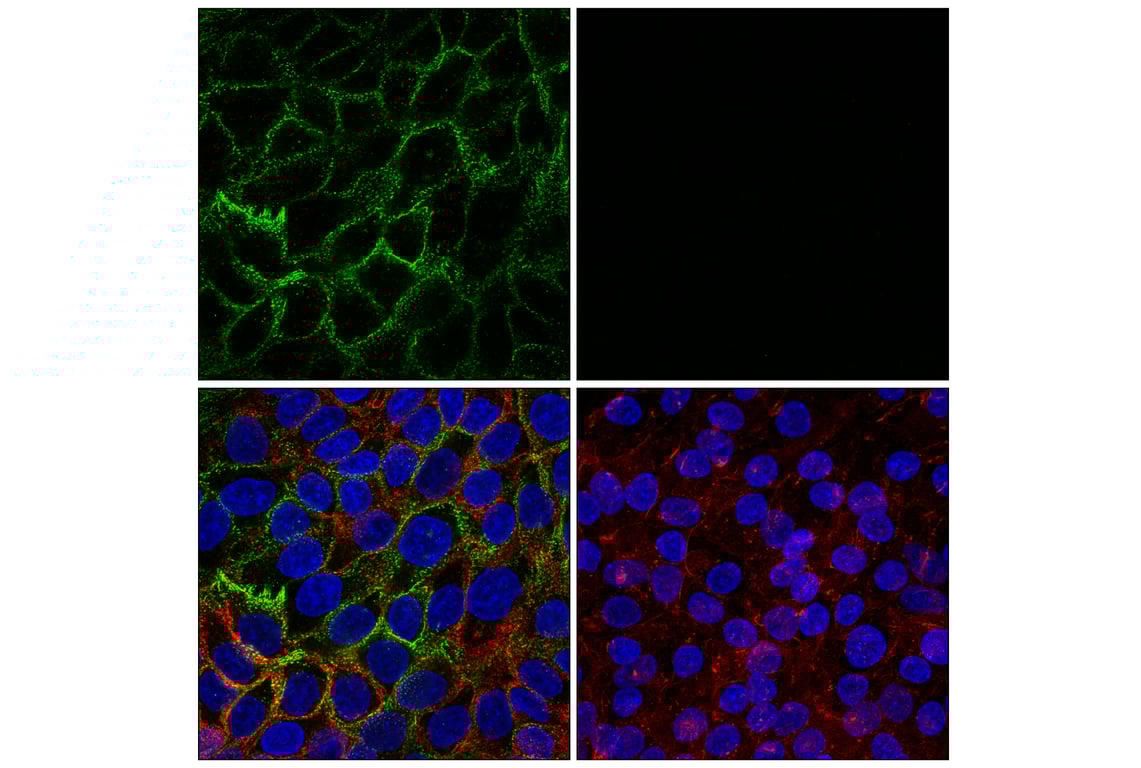 Immunofluorescence Image 1: Desmoglein 2 (8E5) Mouse Monoclonal Antibody