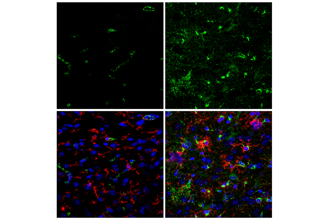 Immunofluorescence Image 1: TSPO (F5B8F) Rabbit Monoclonal Antibody