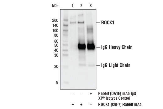 Immunoprecipitation Image 1: ROCK1 (C8F7) Rabbit Monoclonal Antibody