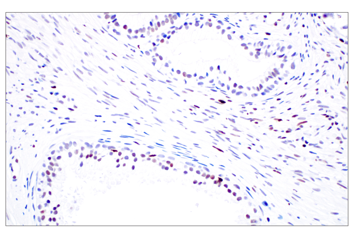 Immunohistochemistry Image 3: Phospho-Histone H3 (Ser10) (D7N8E) Rabbit Monoclonal Antibody (BSA and Azide Free)