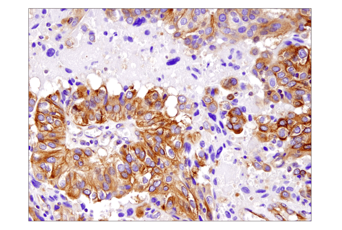 Immunohistochemistry Image 4: beta-Tubulin (D3U1W) Mouse Monoclonal Antibody