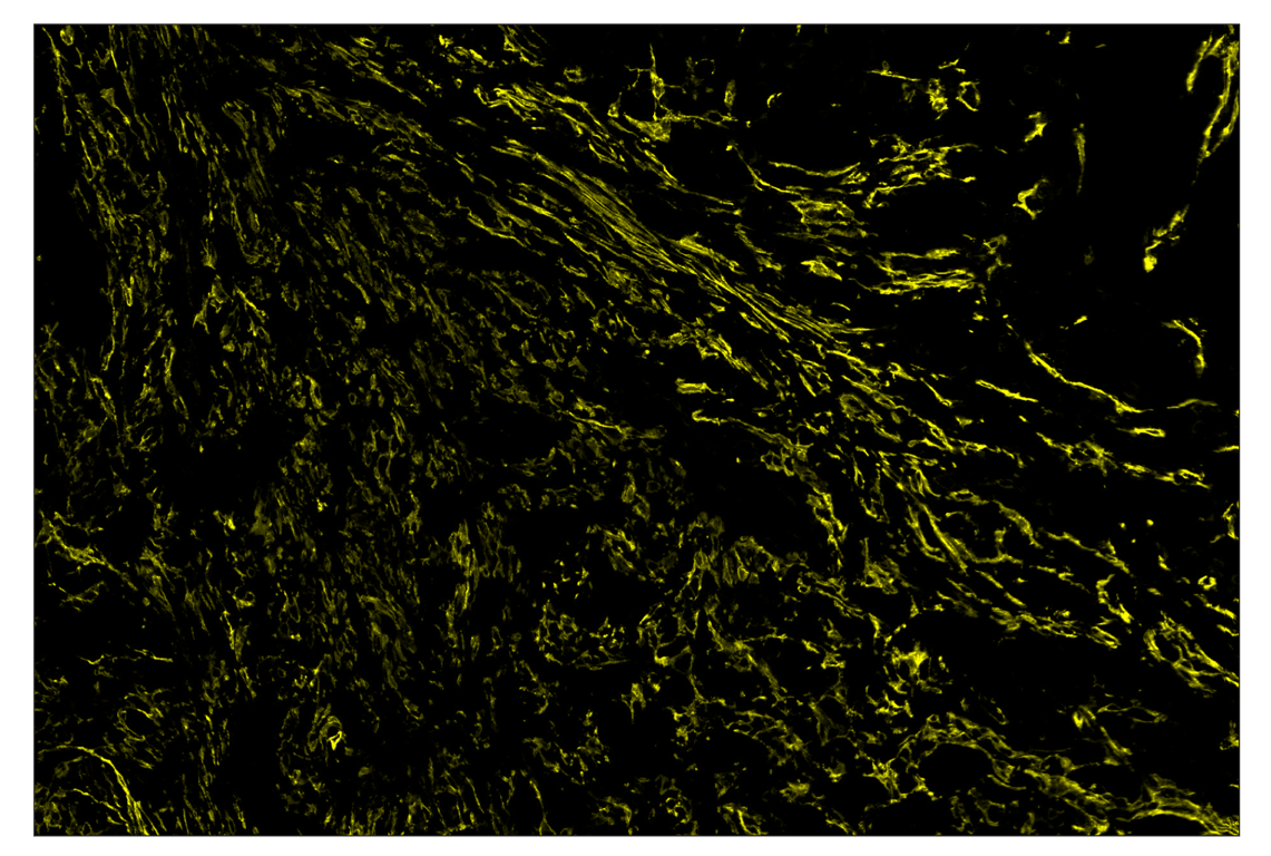 Immunohistochemistry Image 3: FAP (F1A4G) & CO-0116-594 SignalStar<sup>™</sup> Oligo-Antibody Pair