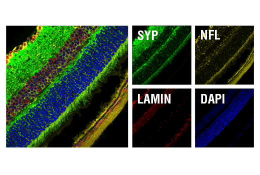 Immunofluorescence Image 1: Synaptophysin (D8F6H) Rabbit Monoclonal Antibody