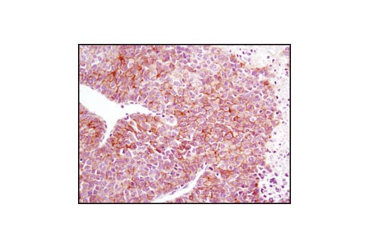 Immunohistochemistry Image 3: EGF Receptor (D38B1) Rabbit Monoclonal Antibody (BSA and Azide Free)