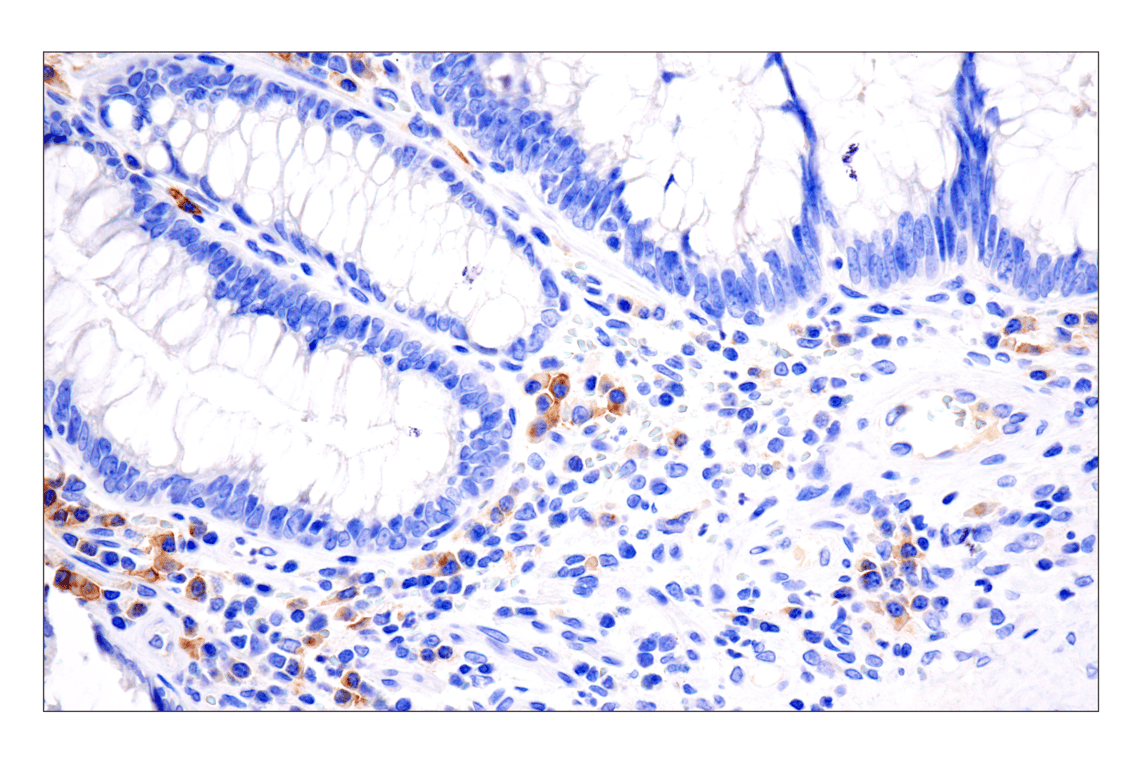 Immunohistochemistry Image 2: TNFRSF17/BCMA (E6D7B) Rabbit Monoclonal Antibody