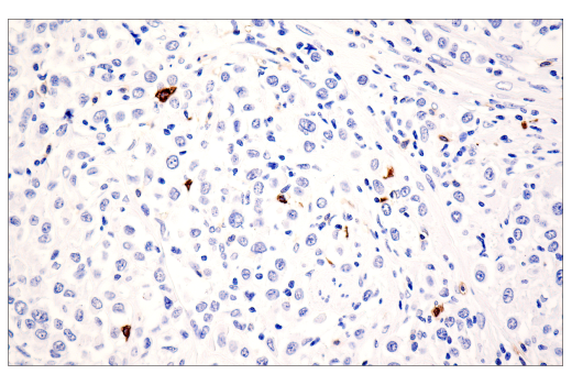 Immunohistochemistry Image 1: CD20 (E7B7T) Rabbit Monoclonal Antibody (BSA and Azide Free)