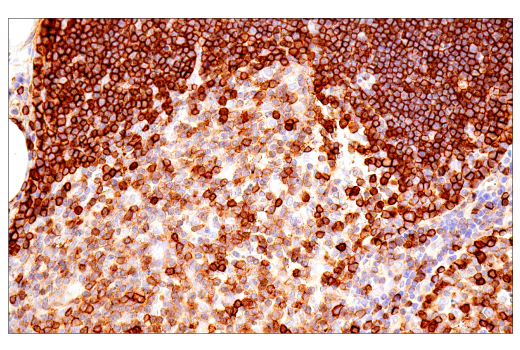 Immunohistochemistry Image 6: CD99 (PCB1) Mouse mAb