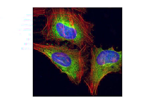 Immunofluorescence Image 1: Asymmetric-Methyl-PABP1 (Arg455/Arg460) (C60A10) Rabbit Monoclonal Antibody