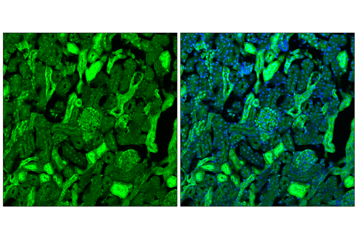 Immunofluorescence Image 2: YAP (D8H1X) Rabbit Monoclonal Antibody