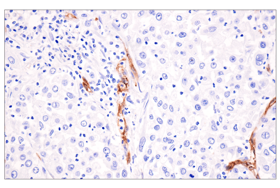 Immunohistochemistry Image 2: ESAM (F2Y5Q) Rabbit Monoclonal Antibody