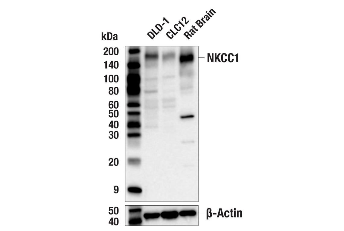 Western Blotting Image 2: NKCC1 Antibody