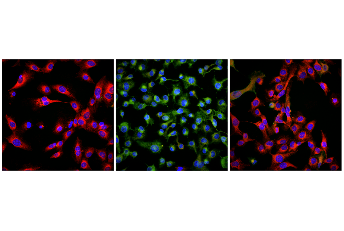 BODIPY 581/591 C11 (Lipid Peroxidation Sensor) | Cell Signaling Technology